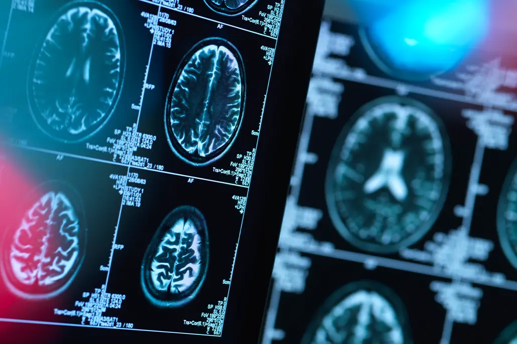 neurotransmitters uit balans